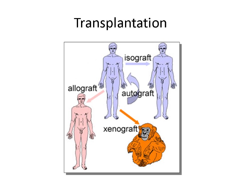 © Ranjith’s Transplantation